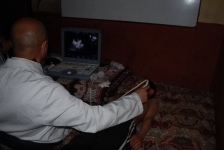 Very sincere thanks to Dr. Anil Bhattarai, Senior Cardiac Consultant and Dr. Dinesh Koirala Senior Paediatric Consultant for their valuable time.